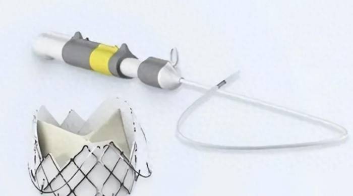 The king of valves, buy a Chinese innovative medical device